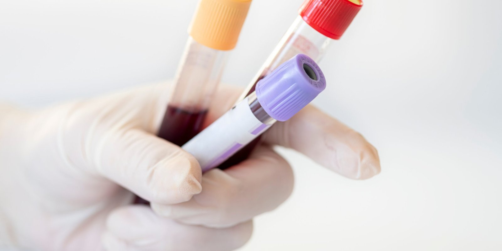 The Importance of Strong Circulation for Male Performance